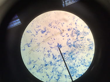 Staying Healthy - Carousel For News Detail