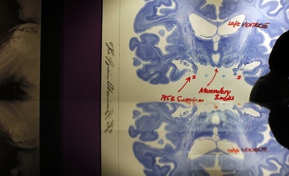 A woman walks past a display of a brain.